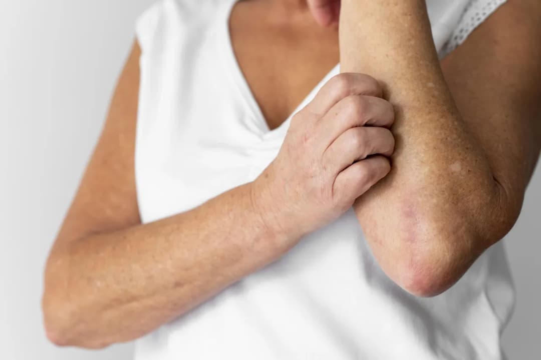 Objawy odrobaczania – co możesz odczuwać po leczeniu pasożytów